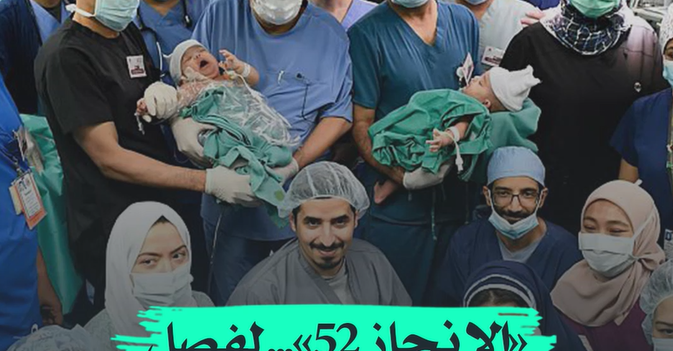 «الإنجاز 52»... لفصل التوائم في السعودية
