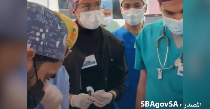 نجاح فصل التوأم السيامي اليمني «مودة ورحمة» في السعودية