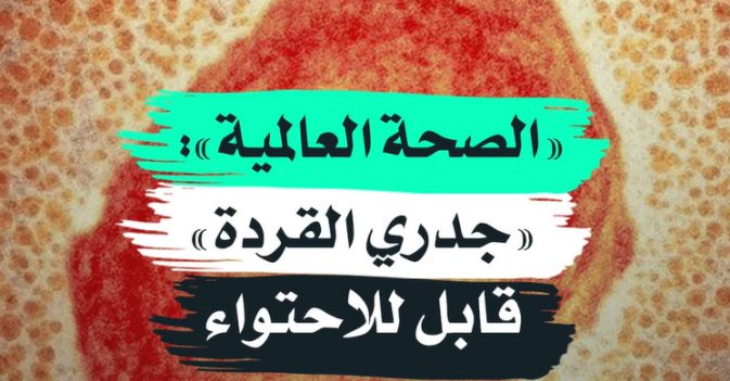 «الصحة العالمية» «جدري القردة» قابل للاحتواء