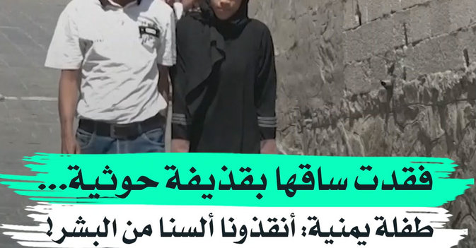 فقدت ساقها بقذيفة حوثية... طفلة يمنية: أنقذونا ألسنا من البشر! 