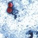 صورة مجهرية من مركز السيطرة على الأمراض (CDC) تُظهر طفيليات «السيكلوسبورا» في عينة براز مصبوغة بالسافرانين (أسوشيتد برس)