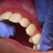 كليات طب الأسنان تُولي اهتماماً أكبر لكيفية تأثير أمراض الفم على باقي أجزاء الجسم (أرشيفية - رويترز)